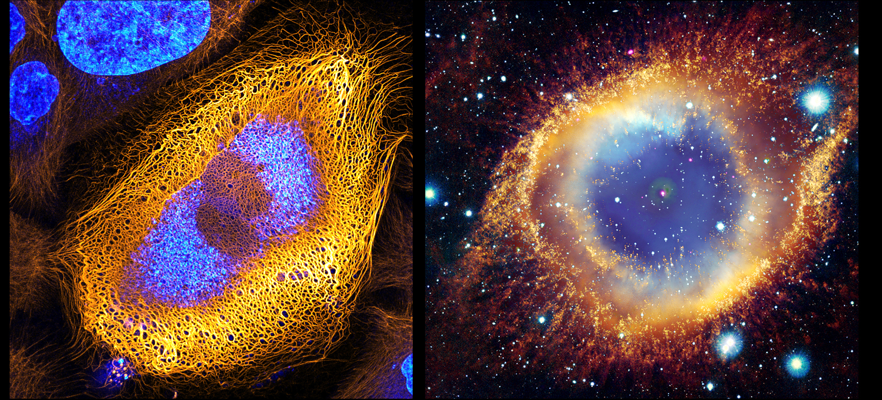Image showing human skin cells under a microscope on the left and an image of the Helix Nebula from telescopes on the right.
