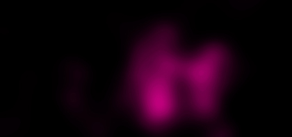 X-ray