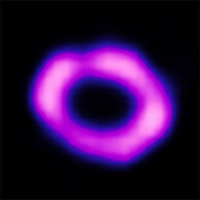Chandra :: Photo Album :: Supernova 1987A :: February 24, 2017