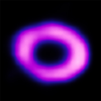 Chandra :: Photo Album :: Supernova 1987A :: More Images 