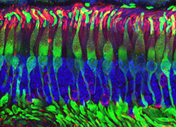 photo of human rod cells under high magnification