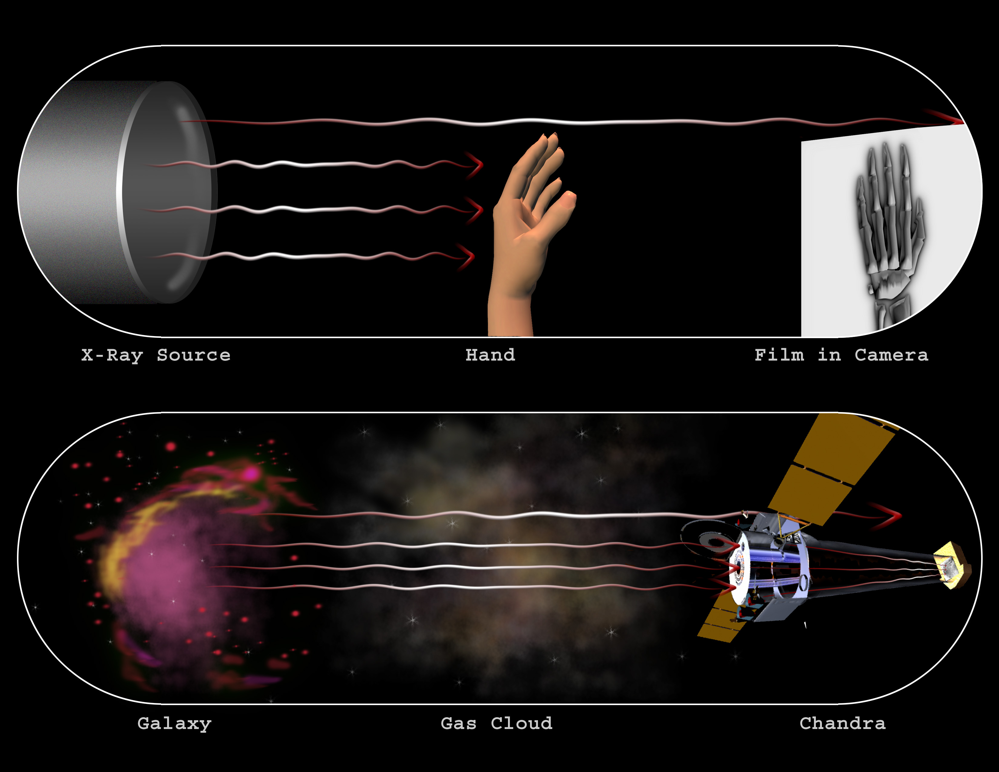 Chandra :: Resources :: X-Ray Astronomy vs. Medical X-Rays