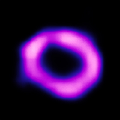 Chandra :: Photo Album :: Supernova 1987A :: More Images 